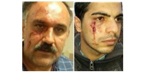 مجروح شدن دو محیط‌بان طی ۴۸ ساعت در مازندران