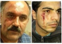 مجروح شدن دو محیط‌بان طی ۴۸ ساعت در مازندران