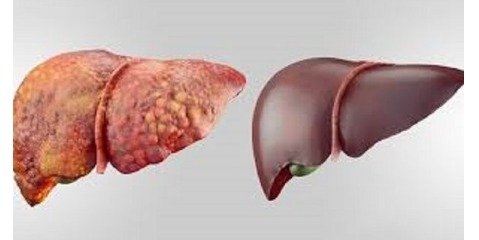 تاثیر فوق العاده امگا ۳ بر کبد چرب