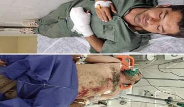 تیراندازی شکارچیان به ۲ محیط‌بان بوشهری